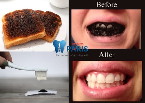 Cách làm trắng răng bằng bánh mì có hại cho sức khỏe không? 2
