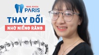 Top 10 ca niềng răng thay đổi ngoạn mục