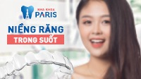 KH chia sẻ sau khi niềng răng