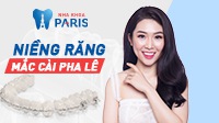 Niềng răng mắc cài pha lê như thế nào?