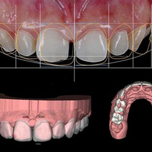AI Smile Design