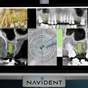 Định vị Navident