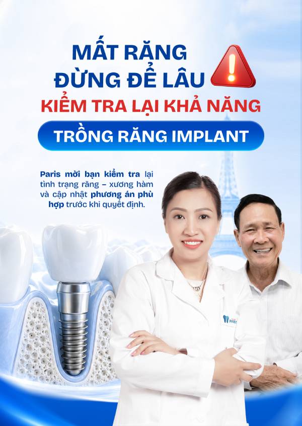 Trồng răng Implant