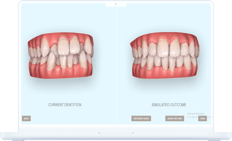 Dental comparison