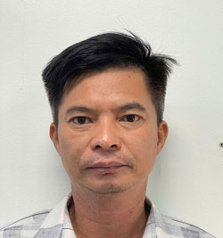 Lo lắng về thẩm mỹ