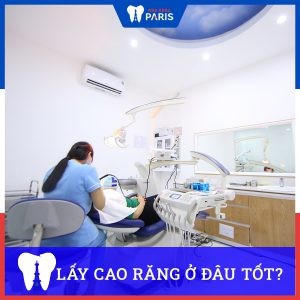 Lấy cao răng ở đâu Tốt, Nhanh, Uy Tín nhất tại Hà Nội, Tp.Hcm