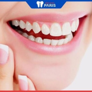 Bọc răng sứ đau không? Trường hợp nào nên áp dụng