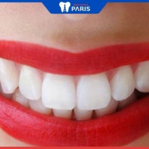 Răng sứ dùng được bao lâu? 4 yếu tố kéo dài độ bền