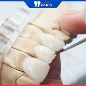 Bọc răng sứ có bị hôi miệng không? 4 cách xử lý hôi miệng triệt để
