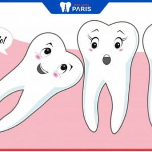 Nhổ răng khôn có nguy hiểm đến sức khỏe không?