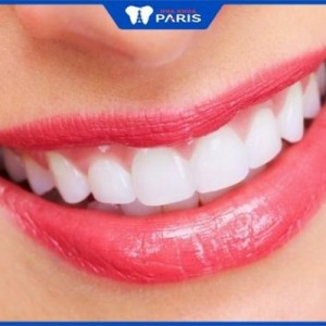 Bọc răng sứ được bao lâu? Làm thế nào để giữ răng sứ luôn bền đẹp?