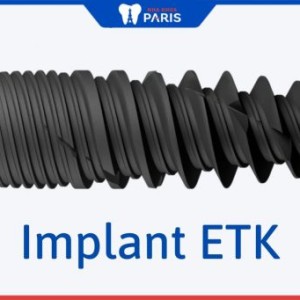 Trụ implant ETK PARIS- Dòng trụ “siêu việt” 8 tuần tích hợp xương