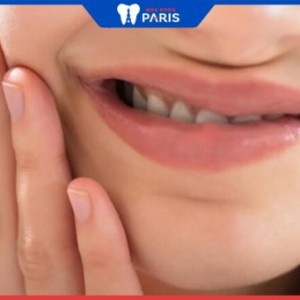 4 Cách giảm ê buốt răng sau khi tẩy trắng hiệu quả