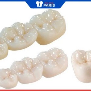 Làm răng sứ zirconia – “lột xác” răng xấu thành răng đẹp lung linh