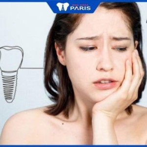 Trồng răng hàm có đau không? Cách giảm đau, khó chịu hiệu quả