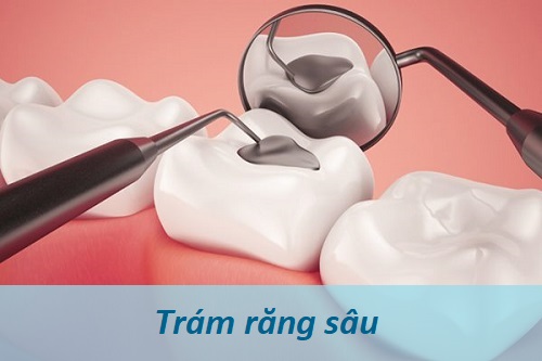 Nhức răng hôi miệng là biểu hiện của bệnh gì?Cách chữa trị triệt để? 3