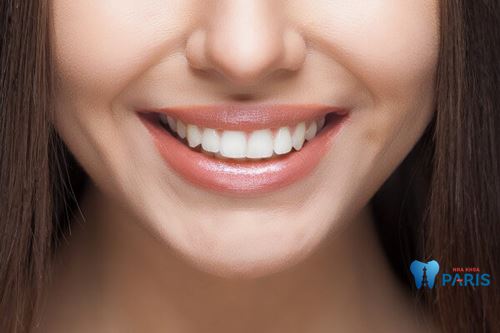 4 Tiêu chí đánh giá Làm răng tại nha khoa Paris có tốt không?