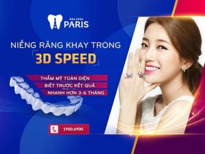 Niềng răng 3D Speed – Công nghệ Độc Quyền Nha Khoa Paris
