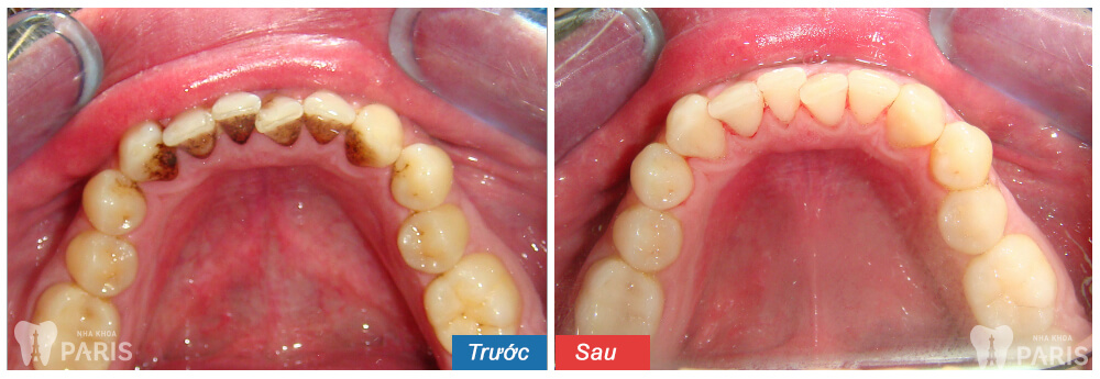 TEETH SPA - Giải pháp chăm sóc răng miệng toàn diện từ chuyên gia 9