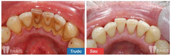 TEETH SPA - Giải pháp chăm sóc răng miệng toàn diện từ chuyên gia 8