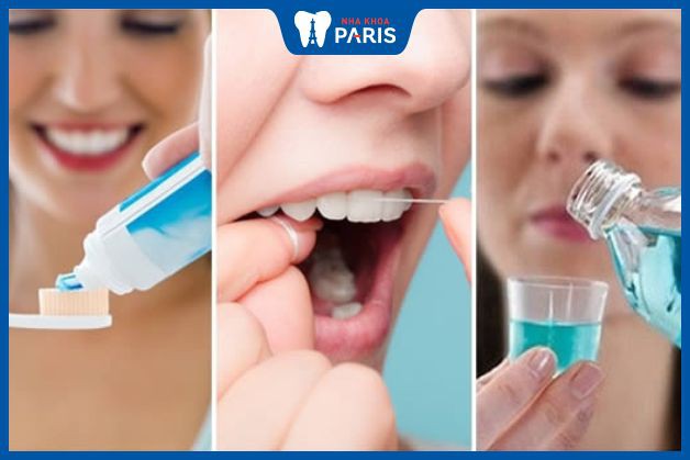Thực hiện đủ các phương pháp vệ sinh răng sẽ hạn chế cao răng