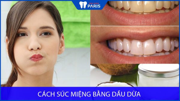 Cách súc miệng bằng dầu dừa cho răng trắng sáng