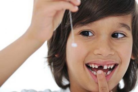 Cách tự nhổ răng sâu tại nhà cho trẻ bằng 1 sợi chỉ