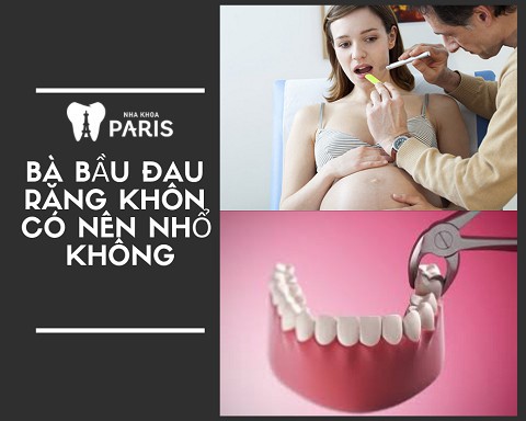 Đau răng khôn khi mang thai được khuyến cáo là không nên nhổ