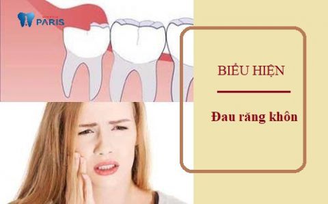 Biểu hiện đau răng khôn 