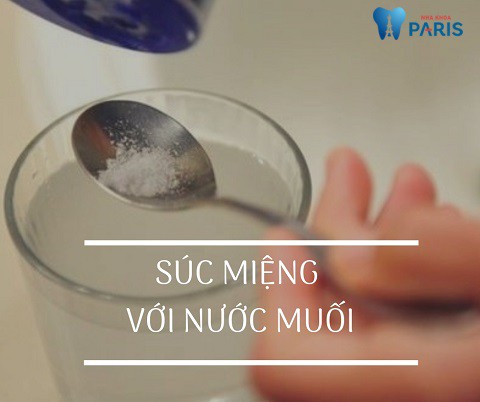 Súc miệng nước muối sẽ giúp giảm viêm, ngăn ngừa vi khuẩn tích tụ trong miệng