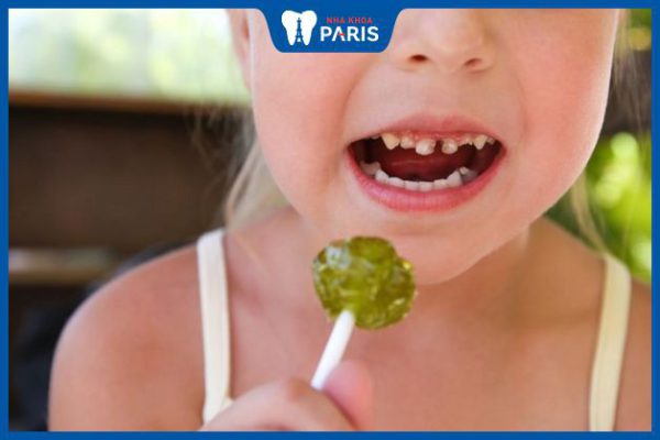 Vì sao trẻ nhỏ ăn kẹo dễ bị sâu răng & Cách ngăn ngừa