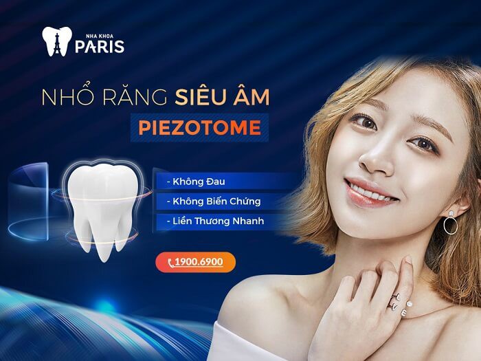 Nhổ răng hàm dưới công nghệ Piezotome