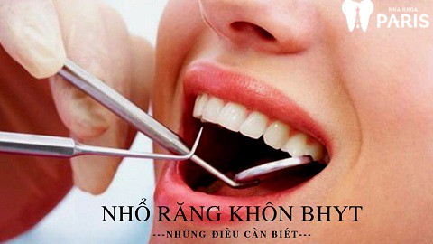 Những điều cần biết về nhổ răng khôn bảo hiểm y tế