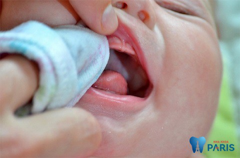 vệ sinh răng miệng cho bé mới mọc răng bằng các lau nướu