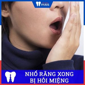 Hôi miệng sau khi nhổ răng khôn: Nguyên nhân và biện pháp xử lý