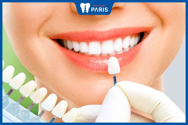 Bọc răng sứ khắc phục răng cửa có kích thước quá khổ