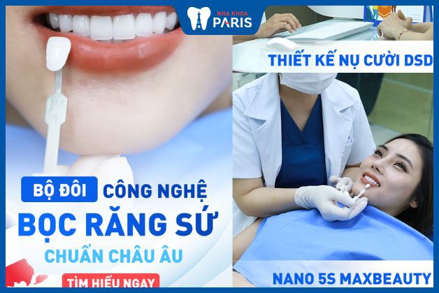 Bọc răng sứ tại Vinh an toàn với công nghệ hiện đại của Nha Khoa Paris