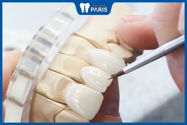 Nha Khoa Paris có xưởng chế tác răng sứ lớn nhất cả nước