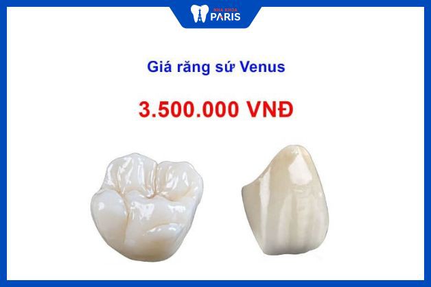 Răng sứ Venus có giá 3.500.000 VNĐ tại nha khoa Paris