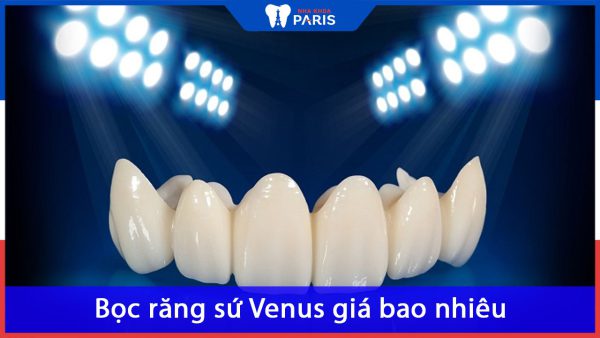 Bọc răng sứ Venus giá bao nhiêu? Có tốt không so với giá tiền?