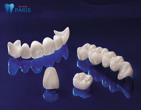 Răng toàn sứ - Dòng răng sứ mang lại tính thẩm mỹ cao, không đen viền nướu