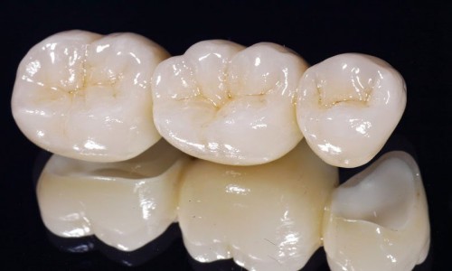 răng sứ ceramill