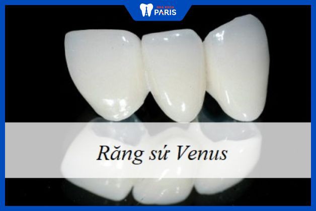 Răng sứ Venus sản xuất tại Đức được sử dụng nhiều nhất