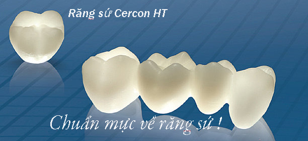 Răng toàn sứ Cercon