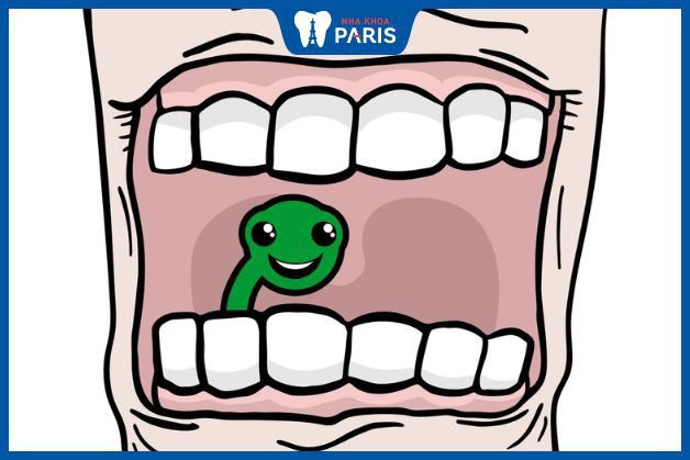 Nhiều ngwoif cho răng sâu răng là do "con sâu" ăn răng