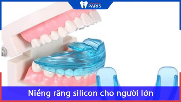 Niềng răng silicon cho người lớn có hiệu quả không?