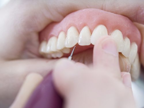 Kinh nghiệm bọc răng sứ có đau không và từ chuyên gia thẩm mỹ - NHA KHOA LÊ  VINH (1009A CMT8)NHA KHOA LÊ VINH (1009A CMT8)