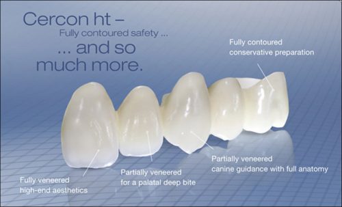răng sứ cercon và cercon ht