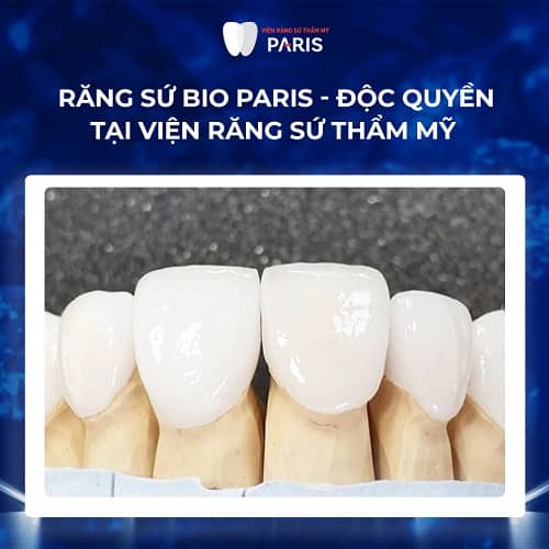 Răng sứ Bio Paris - sự lựa chọn hoàn hảo cho cầu răng
