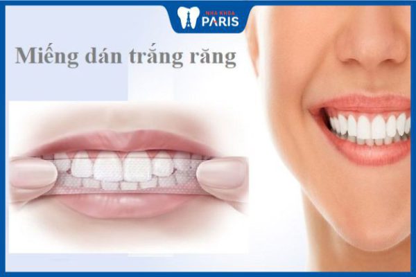 Top 7 miếng dán trắng răng hiệu quả và được ưa chuộng nhất